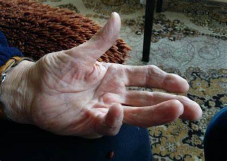 வளைவு விரல் .