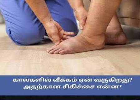 கால்வீக்கத்திற்கு முக்கிய காரணங்கள்.