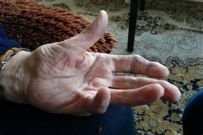 வளைவு விரல் .